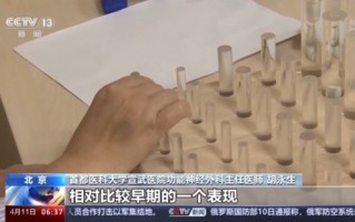 帕金森病也盯上了年轻人：严重社交孤立者患病风险高