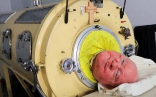 世界最后一名“铁肺”人去世 在铁桶中生活了70余年